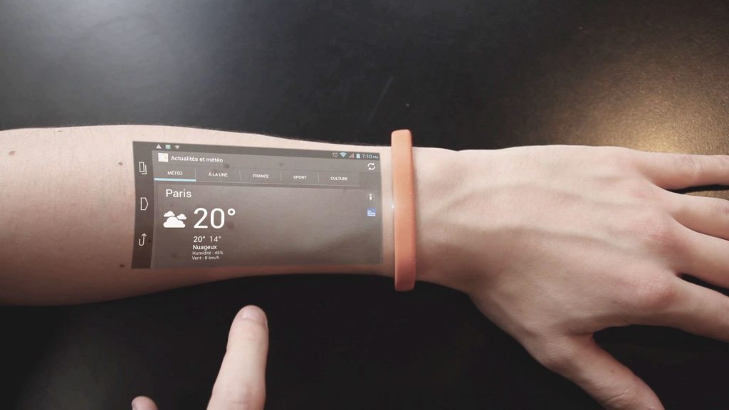 This Bracelet Makes Your Arm a Phone