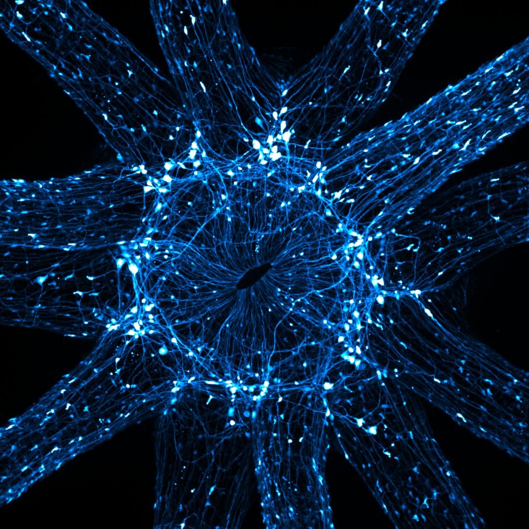 m2-Nikon-Small-World-Photomicrography-Competition-3